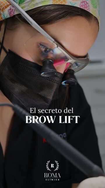 ¿Notas que tus cejas han perdido su posición y tu mirada se ve más cansada o apagada? 

Hoy, la Dra. Helena nos habla del Brow Lift, un tratamiento que ayuda a elevar sutilmente las cejas, abrir la mirada y conseguir un aspecto más fresco y rejuvenecido, siempre respetando la armonía natural del rostro.

Descubre en este vídeo en qué consiste, para quién está indicado y los resultados que se pueden conseguir.

¿Tienes dudas o quieres saber si el Brow Lift es adecuado para ti? Déjanos un comentario o escríbenos por mensaje directo. ¡Estaremos encantados de ayudarte!

“Resultados individuales. Cada paciente puede obtener resultados diferentes. Valoración médica previa necesaria.”

📲 951 536 845 / 645 020 214
📍 Dirección: Trinidad Grund 7, 1D, Málaga Centro
🌐 Página web: www.clinicasroma.com

#clinicaroma #malaga #browlift #blerafoplastia #cejas