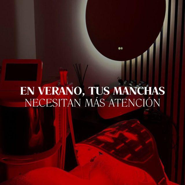 El verano no es momento de olvidarnos de las manchas, sino de aprender a controlarlas.
La exposición solar puede hacer que se intensifiquen, por eso durante estos meses priorizamos la prevención, la fotoprotección y aquellos cuidados que nos ayudan a mantener la piel en las mejores condiciones.
En Clínica Roma valoramos cada caso de forma individual para establecer un protocolo adaptado al tipo de mancha, al estado de la piel y al momento del año.
☀️ En verano: protegemos, prevenimos y controlamos.
❄️ En invierno: podemos avanzar con tratamientos más intensivos.
El tratamiento de las manchas requiere constancia, seguimiento y, sobre todo, una estrategia personalizada.
“Resultados individuales. Cada paciente puede obtener resultados diferentes. Valoración médica previa necesaria.”
Solicita tu valoración en Clínica Roma.
📲 951 536 845 / 655 538 090
📍 Dirección: Trinidad Grund 7, 1D, Málaga Centro
🌐 Página web: www.clinicasroma.com
#malaga #clinicaroma #verano #manchas #acidohialuronico