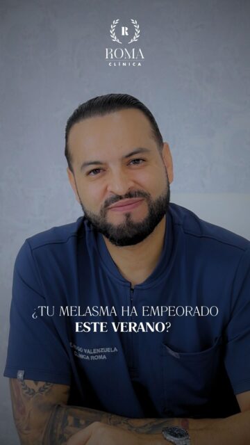 Si después de los meses de verano notas que tus manchas están más oscuras o son más visibles, hay una explicación.
La exposición solar, el calor y la luz visible pueden estimular la pigmentación y hacer que el melasma se intensifique.
Hoy te contamos por qué ocurre y qué podemos hacer para cuidar tu piel después del verano.
📲 951 536 845 / 645 020 214
📍 Dirección: Trinidad Grund 7, 1D, Málaga Centro
🌐 Página web: www.clinicasroma.com
#Melasma #ManchasFaciales #Hiperpigmentacion #CuidadoDeLaPiel #SaludDeLaPiel