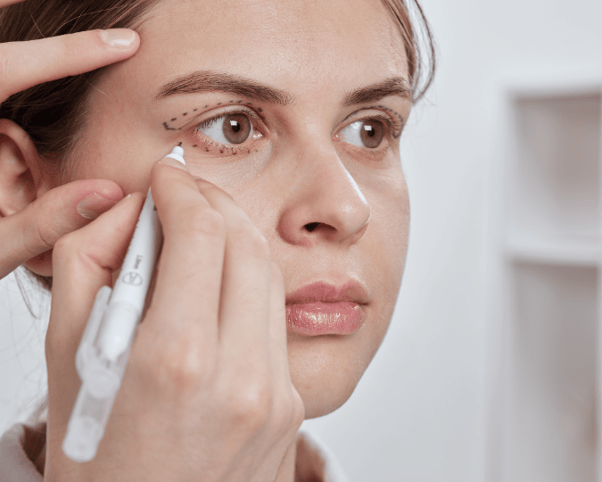 Imagen procedimiento de blefaroplastia