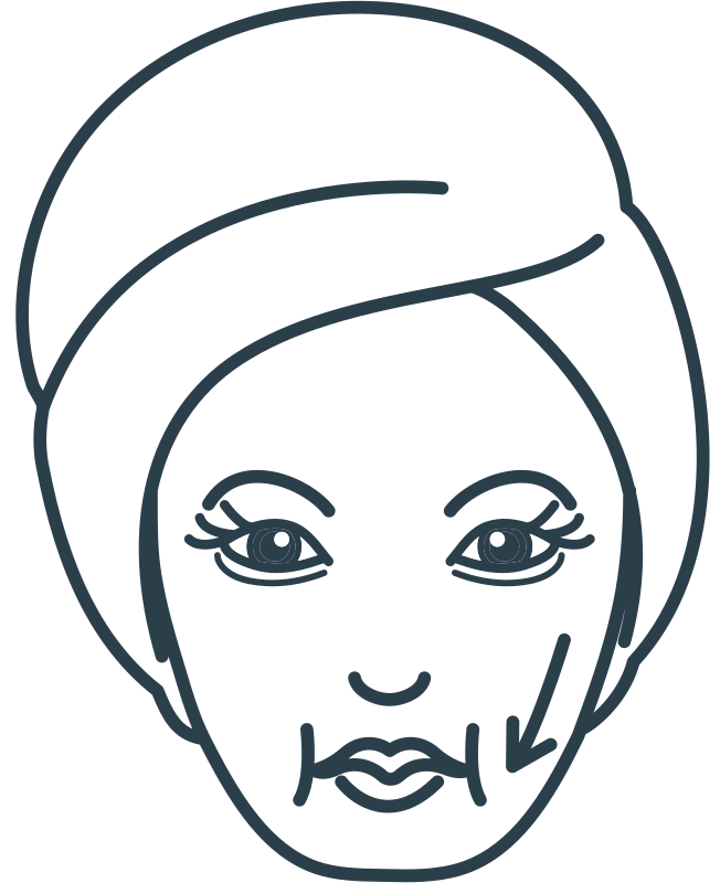 tratamiento de flacidez facial en la mejor clinica estetica malaga