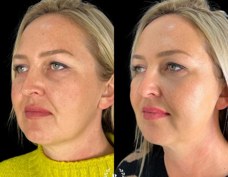 La mejor clinica de medicina estética de todo málaga