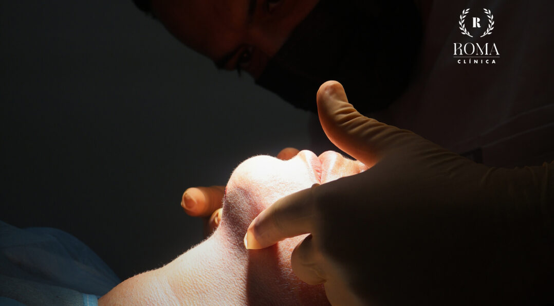 El mejor procedimiento de armonización facial en malaga