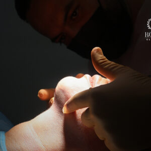 El mejor procedimiento de armonización facial en malaga