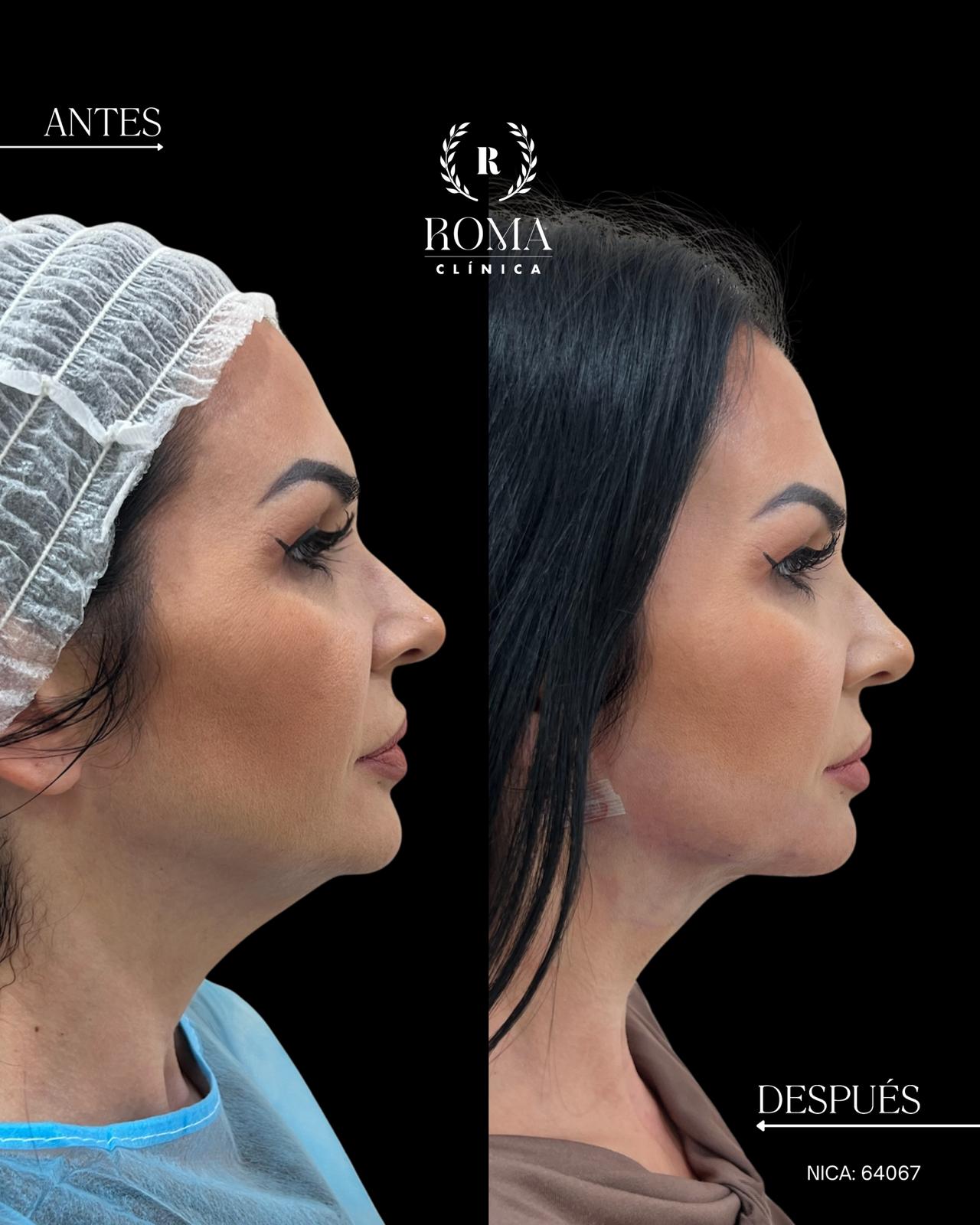 Renueva tu look y define el contorno de tu rostro