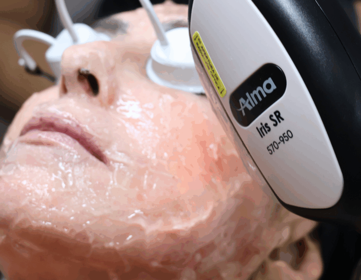 Descubre el mejor servicio para desmanchar la piel