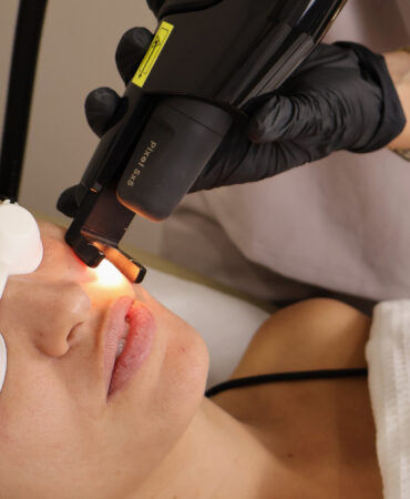 Los mejores tratamientos para cuidar tu piel en esta temporada navideña