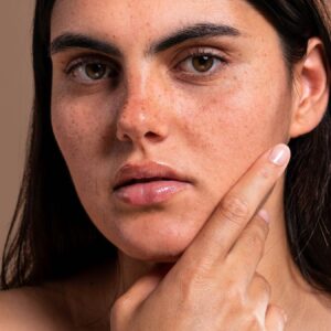 Disminuye las manchas del sol