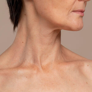 Realízate el mejor procedimiento para disminuir la edad