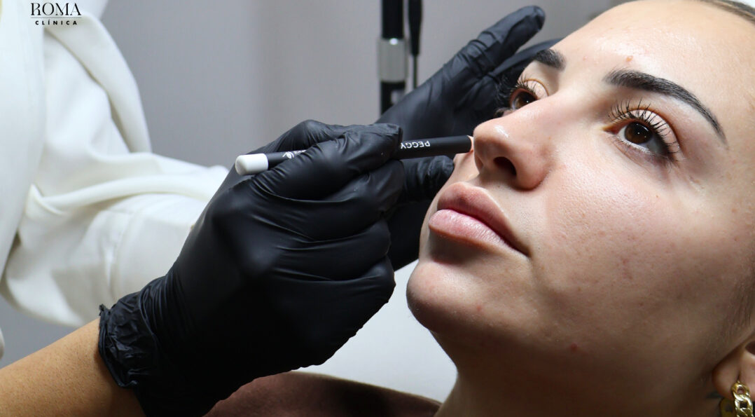 Clínica Roma Málaga, la mejor opción para tu belleza