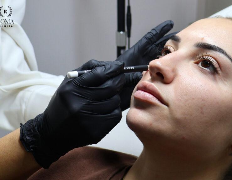 Clínica Roma Málaga, la mejor opción para tu belleza