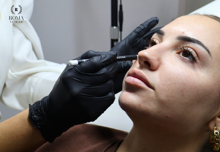 Clínica Roma Málaga, la mejor opción para tu belleza