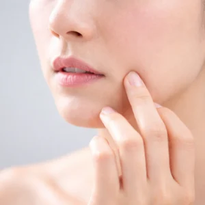 Disminuye la apariencia de las Manchas en Málaga