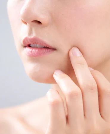 Disminuye la apariencia de las Manchas en Málaga