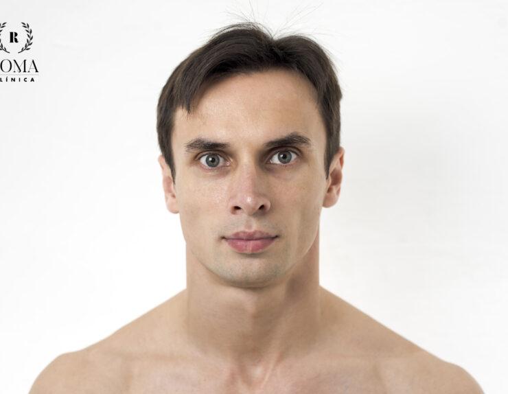 Tratamiento de belleza para hombres