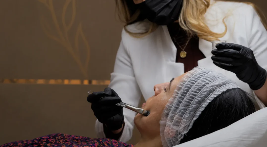 Peeling facial antes de un evento