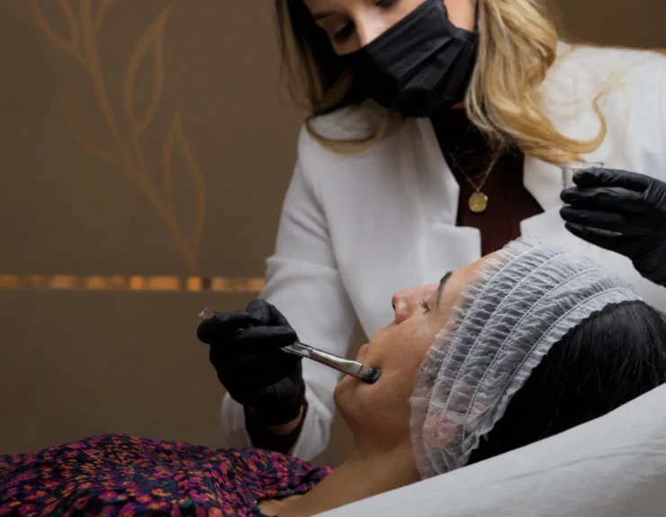 Peeling facial antes de un evento