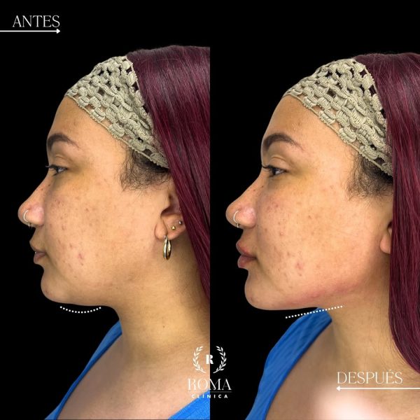 468568014_17908263477053293_8836748510861843143_n