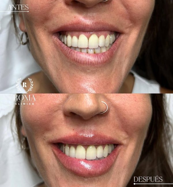 568971903_17946318663053293_1119746632078805233_n