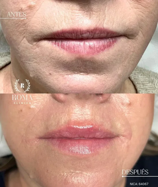 ClÃ_nica Roma Medicina EstÃ©tica en Malaga