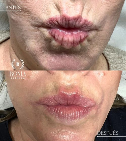 Los mejores tratamientos de medicina estetica